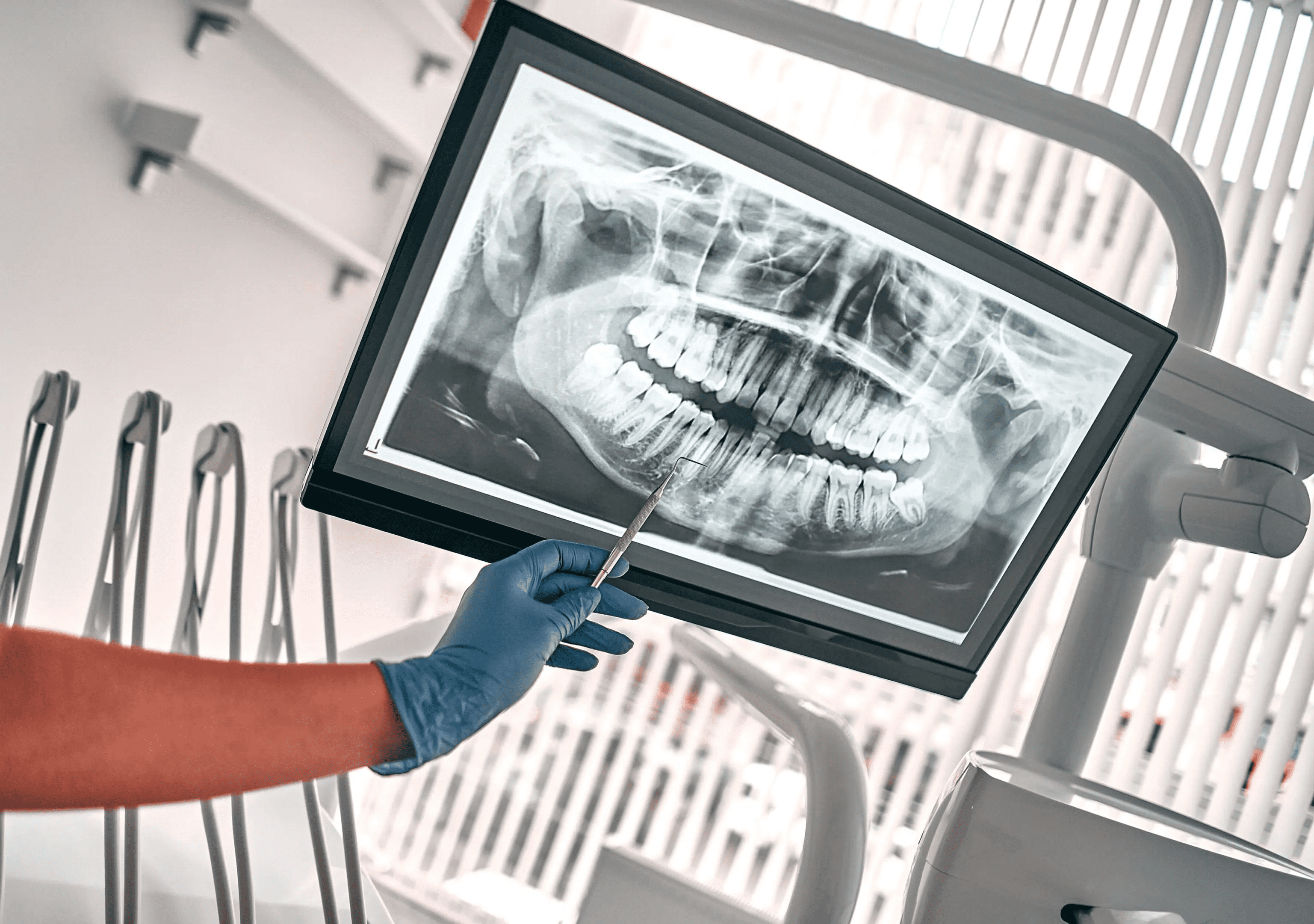 Dentist examining a dental X-ray image on a screen with a pen.