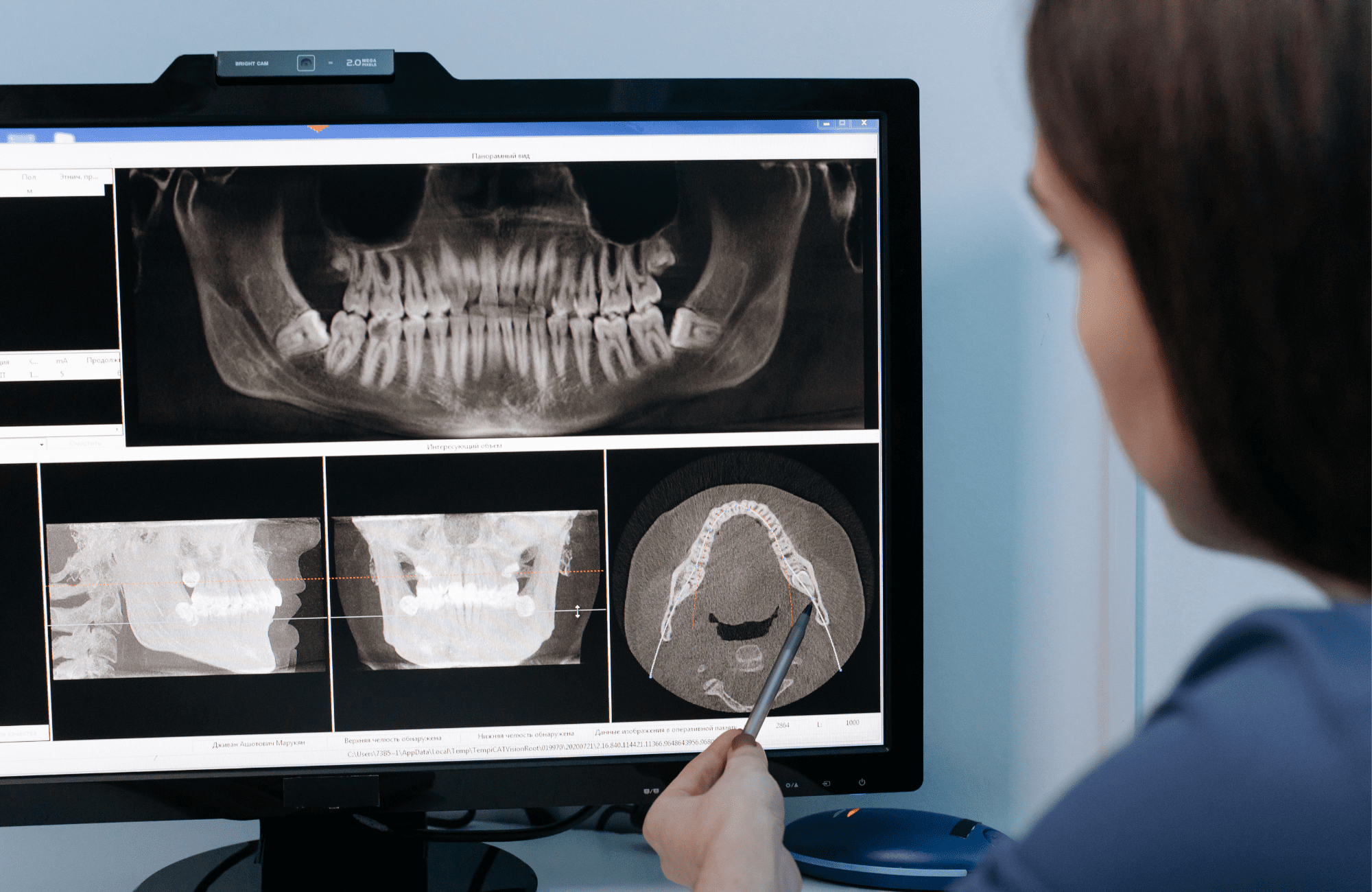 Dentist examining dental X-rays on a computer screen.