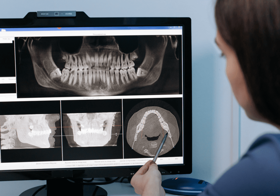 Dentist examining dental X-rays on a computer screen.
